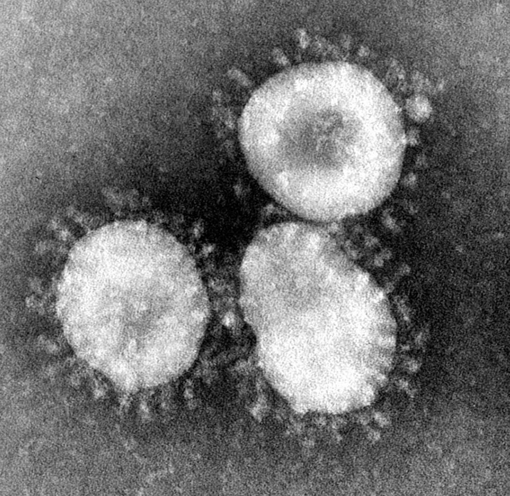 GoLocalProv | NEW: RI Dept. of Health Forms Coronavirus Task Force, Takes Preparedness ...1034 x 1006